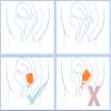 Merula Cup XL Fox  The Menstrual Cup for The Very Strong Days view 4