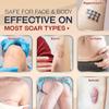 Ebanel Silicone Scar Gel with Allantoin, Emu Oil, Vitamin E and Onion Extract, For Old & New Scars from Surgeries, C-Section, Injuries, Burns & More view 3