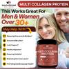Wholesome Wellness Premium Multi Collagen Peptides Powder for Women and Men | 5 Types of Hydrolyzed Collagen | Grass-Fed, Non-GMO & Unflavored | Pure Protein for Youthful Skin & Joint Recovery view 4