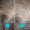 NitWits Head Lice & Egg Comb 2 Pack, 3-in-1 Lice Comb, Detangles, Removes Lice & Eggs and Includes 5x Magnifying Glass view 4