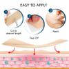 Scarbandit Silicone Scar Tape  Reusable Scar Sheets for Surgical Scars, Keloid Bump Removal, Burn, Acne Treatment, Stretch Mark Removal & c-Section  Waterproof & Breathable 118inch Scar Strips view 4