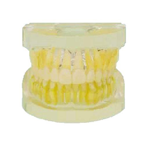 28 Teeth Removable Standard Dental Model (Removable Standard Dental Model (28pcs Teeth,Hard Gum))