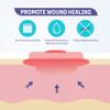 Conkote Hydrocolloid Wound Dressing 4x 4, Sterile Thin Adhesive Patches, Box of 10 Dressings view 4