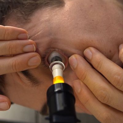 S5 Mini: for Easy and Accurate Scleral & Hybrid Lens Insertion - Perfectly Align Your Eye with The Center of The Lens and Use 2 Hands to Hold Your Eyelids Open