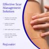 Rejuvaskin Scar Heal Kit for Small to Medium Scars, Soften, Flatten, Reduce and Recover, Silicone Sheeting, RejuvaSil Gel & Medical Tape, 1.5" x 5" view 3