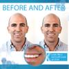 Instant Smile Complete Your Smile Temporary Tooth Replacement Kit - Replace a Missing Tooth in Minutes - Patented view 3