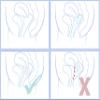 Merula Cup XL ice - The Menstrual Cup for Very Heavy Flow Days view 4