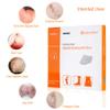 Silver Calcium Alginate Wound Dressing Pad, 4x5 Patch, High Absorbency Non-Stick Ag Gauze for Pressure Ulcer,Bed Sore,Leg Sore,Diabetic Foot Ulcer, 5 Packs view 3