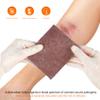 Silver Calcium Alginate Wound Dressing Pad, 4x5 Patch, High Absorbency Non-Stick Ag Gauze for Pressure Ulcer,Bed Sore,Leg Sore,Diabetic Foot Ulcer, 5 Packs view 4