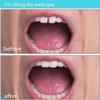 Brige Tooth Repair kit for Filling The Missing Broken Tooth and Gaps-Moldable Fake Teeth and Thermal Beads Replacement Kit for Women and Men view 4
