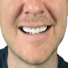 2 Pack - Instant Smile Natural Shade Comfort Fit Flex Veneers - Fix Your Smile from The Comfort of Your own Home in just Minutes! Hand Crafted view 4