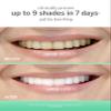 Supersmile Extra White Triple Mint Whitening Toothpaste  Professional Formula for Visibly Whiter Teeth  Whitens Up to 9 Shades, 7 oz view 3