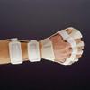 Rolyan Anti-Spasticity Ball Splint with Slot & Loop Strapping, Left, Medium, Positioning Splint for Moderate to Severe Spasticity, MS, Stroke, Cerebral Palsy, or Other Disabilities view 1