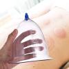 Healifty Cupping Massage Silicone Cupping Body Massage Cups Traditional Suction Cups for Back Neck Body view 3