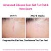 LIPOELASTIC Silicone Scar Cream for Surgical Scars 10g, Medical Grade Silicone Scar Gel with Vitamin E for C-Section, Burn, Stretch Marks, Wound, Old Scar, Acne Scar Treatment, Crema para Cicatrices view 4