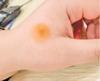60pcs/Set Moxibustion Stick Smokeless Roll Self-Adhesive Moxa Chinese Medical Acupuncture Points Massage Sticker view 2