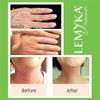 Natural Eczema Cream, Itch Relief for Atopic dermatitis, Soothing & Intensively Moisturizing, Dry cracked Skin Balm, Anti Itch Ointment, 10X Organic aloe vera, ceramides, LEMYKA, 2OZ view 4