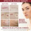 Physician Formulated Silicone Scar Gel Semi-Solid Sheeting - Advanced Crosspolymer Medical Grade Liquid Sheeting for Face, Body, Surgery, C Section, Burn, Keloidal & Hypertrophic Scars view 4