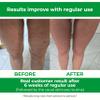 TESMED Cellulite Manual Massager : Made in Italy, Patented with Converging & Diverging Roller Technology. Anti Cellulite Roller for Thighs and Buttock view 4