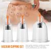 12 Pcs Vacuum Cupping Set Massager Cans Suction Cups Set Acupuncture Physical Therapy Suction Health Care Massaer view 2