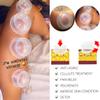 6 Sizes Cupping Therapy Set-Professional Cupping Therapy Studio and Household Silicone Cupping Set, Stronger Suction, Suitable for Myofascial Massage, Muscle, Nerve, Joint Pain view 3