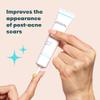 Proactiv Post Acne Scar Gel, Bakuchiol & Vitamin E Face Treatment for Smoothing Skin Texture, Reducing Scars & Enlarged Pores, 1 Oz view 2