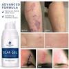 100% Silicone Scar Gel Scar Cream - Advanced Scar Gel for Surgical Scars, C-Section, Stretch Marks, Acne, Injury, Burns, Keloids, Old and New Scars 1.06oz(30g) (Maximum Strength 100% Silicone) view 3