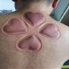 4 Pcs Love Heart Shape Plastic Cupping Cups of Cupping Set Plastic PC Vacuum Cupping Suction Cupping? view 3