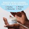 PSORIASIS HONEY Skin-Renewing Cream - Eczema & Seborrheic Dermatitis Cream - Psoriasis Treatment for Skin, Redness & Itch Relief (4oz) view 3