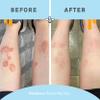 PSORIASIS HONEY Skin-Renewing Cream - Eczema & Seborrheic Dermatitis Cream - Psoriasis Treatment for Skin, Redness & Itch Relief (4oz) view 4