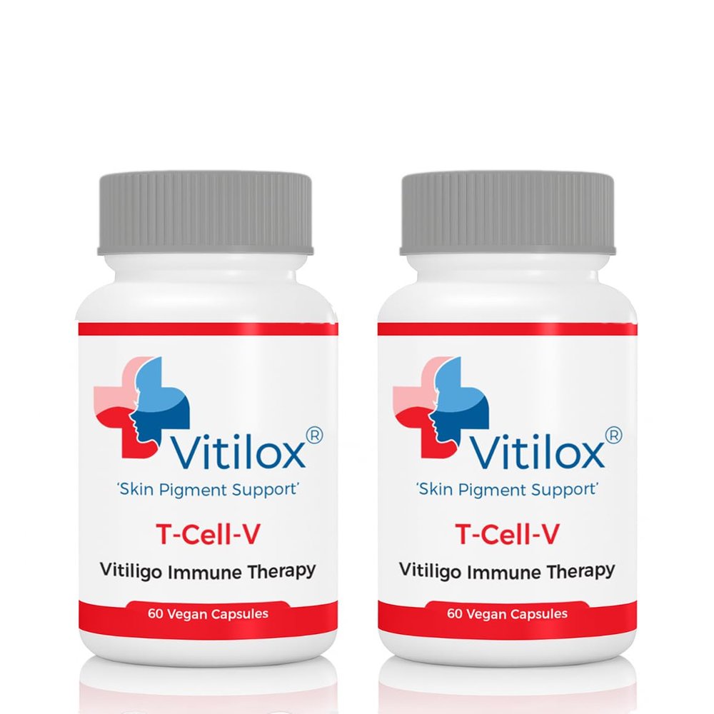 Vitilox Vitiligo T-Cell-V Immune Therapy Capsules  4 Months Supply