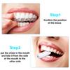 20 Pieces Aligner Tray Seaters for Aligner Trays Chompers Orthodontic Trays(Light Pink, Red, Green, Lavender, Light Yellow) view 3
