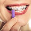 20 Pieces Aligner Tray Seaters for Aligner Trays Chompers Orthodontic Trays(Purple) view 3