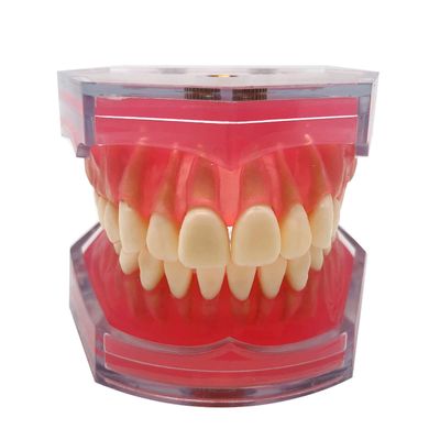 BOVDC Standard Teeth Model, Dental Crown Models Soft Gums, Dental Model Resin Removable Full Mouth Teeth for Tooth Extraction Exercises, Doctor Explains to The Patient