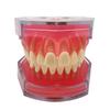 BOVDC Standard Teeth Model, Dental Crown Models Soft Gums, Dental Model Resin Removable Full Mouth Teeth for Tooth Extraction Exercises, Doctor Explains to The Patient view 1