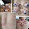 7Pcs Heart and Star Shaped Cupping Cups 1 Cupping Gun Plastic Vacuum Cupping Therapy Set Cupping Kit Massager with Box view 3