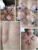 10Pcs Heart and Star Shaped Cupping Cups 1 Cupping Gun Plastic Vacuum Cupping Therapy Set Cupping Kit Massager with Box view 3