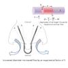 Silent Mammoth Reusable Adjustable Nasal Dilator (Large) Opens Nose to Breathe Easily view 4