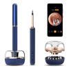 BEBIRD Note3 Pro Max,Ultimate Version,10 Megapixel HD,All-in-1 Ear Wax Removal with Camera,Ear Wax Removal Tool with 25 Pieces,Tweezer and Rod,Bebird Ear Cleaner,for iPhone,AndroidBlue view 1
