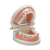 Dental Orthodontic Study Model Teeth view 1