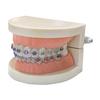 Dental Orthodontic Study Model Teeth view 2