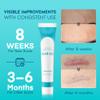Aroamas Scar Advanced Scar Gel - Medical-Grade Silicone Scar Gel to Help Improve The Appearance of Scars and Stretch Marks for Face & Body - 45g view 3