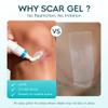 Aroamas Scar Advanced Scar Gel - Medical-Grade Silicone Scar Gel to Help Improve The Appearance of Scars and Stretch Marks for Face & Body - 45g view 4