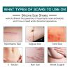 Silicone Scar Sheets (1.6 x 120 Roll-3M), Silicone Scar Tape Roll, Scar Silicone Strips, Reusable, Professional Scar Removal Sheets for C-Section, Surgery, Burn, Keloid, Acne et view 2
