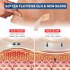 Silicone Scar Sheets (1.6 x 120 Roll-3M), Silicone Scar Tape Roll, Scar Silicone Strips, Reusable, Professional Scar Removal Sheets for C-Section, Surgery, Burn, Keloid, Acne et view 3