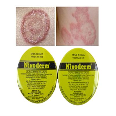 Nixoderm for Skin Problems Cream 20g Ayurvedic Ointment Cream Pack of (2)