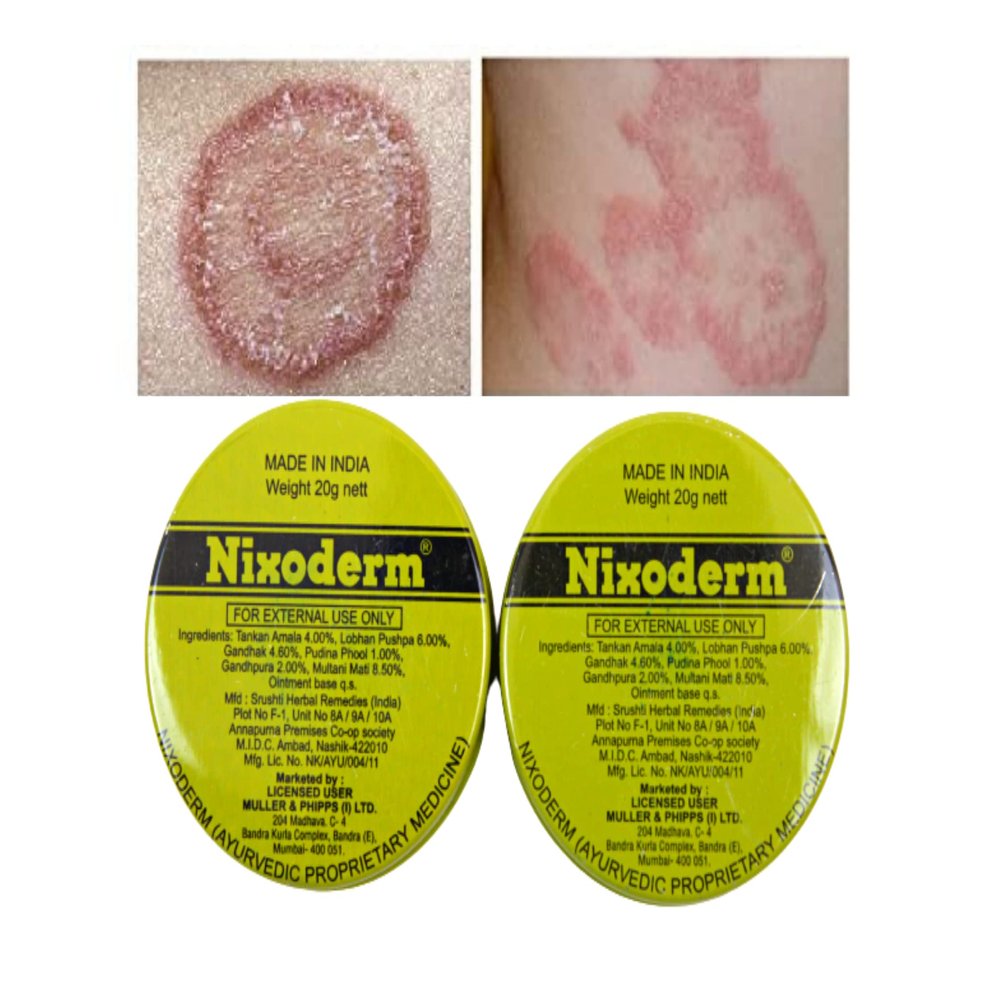 Nixoderm for Skin Problems Cream 20g Ayurvedic Ointment Cream Pack of (2)