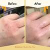 ECZEMA HONEY Original Skin-Soothing Cream - Organic Hand & Body Eczema Relief - Natural Honey Lotion for Dry, Itchy, & Irritable Skin (4 Oz) view 4