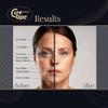 CureTape Beauty Kinesiology Tape | Anti-Wrinkle Face Tape | Face Neck Lift Tape for Toning, Firming & Tightening The Skin | Kinesiology Tape for Face and Sensitive Skin | Soft on The Skin (2'' X 16') view 4
