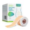 Medical Grade Silicone Scar Sheets, Silicone Scar Tape (1.6x 60), Scar Removal Strips for Acne Scars C-Section & Keloid Surgery Scars Sheets Treatment Sheets - 6-8 Month Supply view 1